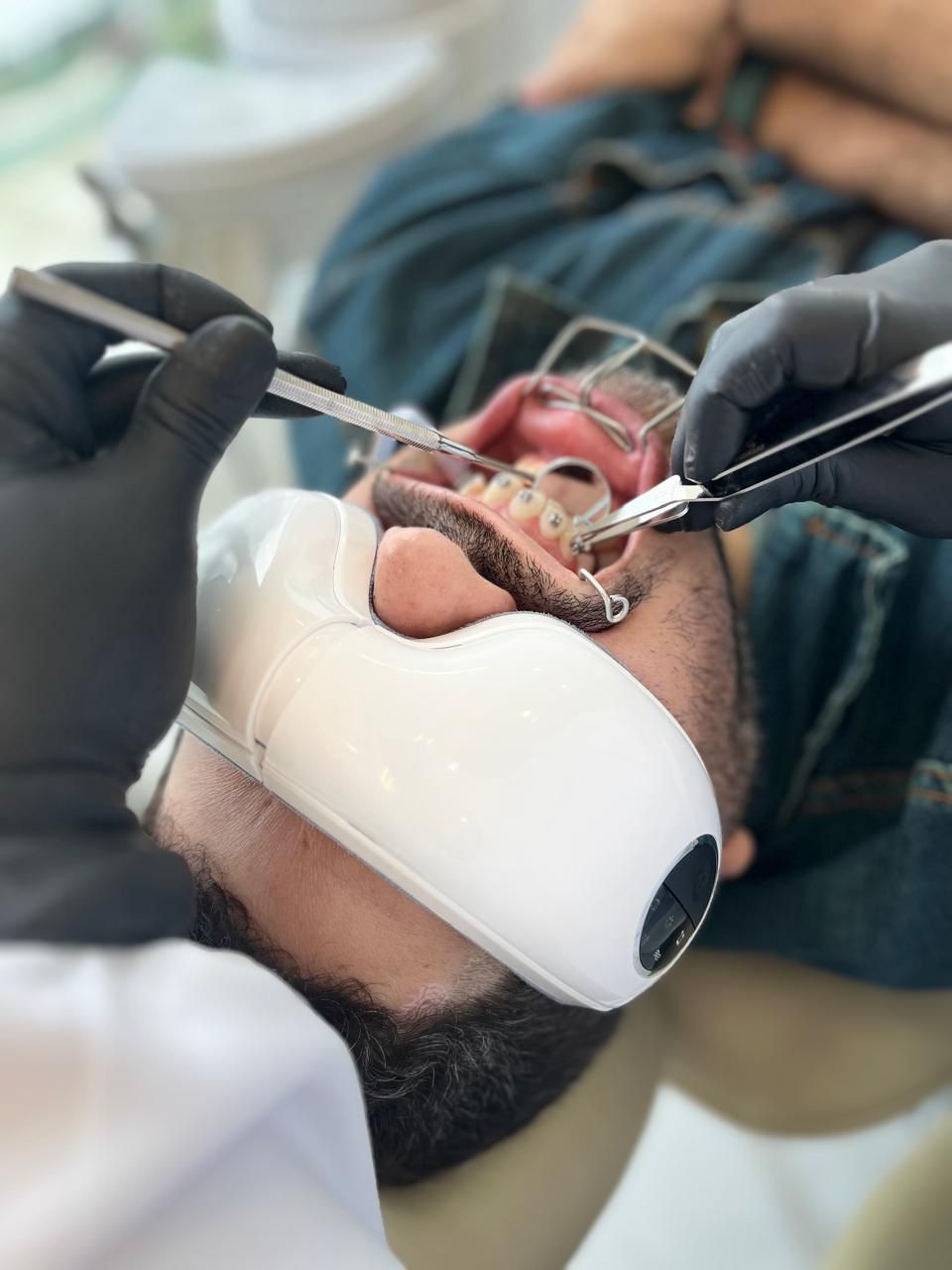 Dra. Gilliane realizando procedimento ortodôntico em paciente com afastador labial